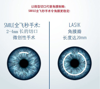 武汉阿玛施眼科全飞秒与LASIK手术对比图.jpg